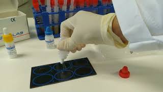 [ENG SUB] Immunology C-Reactive Protein (CRP) test