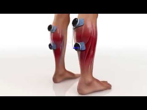 perder peso sin razon COMPEX Wireless. Combina entrenamiento voluntario con la electroestimulación