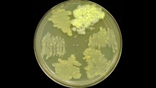 Middlebrook Medium Agar-Based And Liquid Media Used For Cultivation Of Mycobacterium Tuberculosis