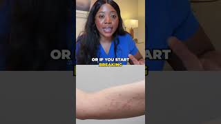 Bee and Wasp Sting Treatment: Pain Relief & Allergy Signs