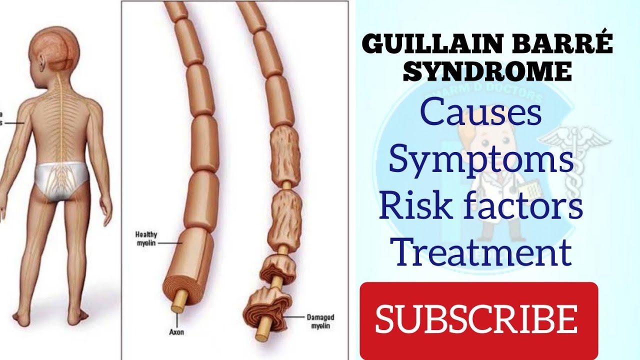 Guillain Barre Syndrome Gb Syndrome Explained Briefly Dr Medicine Youtube Guillain Barre Syndrome Gb Syndrome Explained Briefly Dr Medicine Youtube
