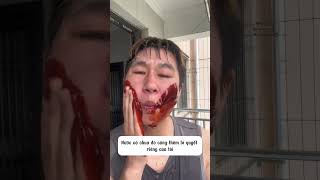 Ngày thứ 66 trong thử thách trị mụn 100 ngày của tôi!