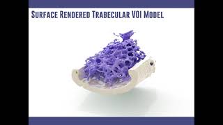 X-ray Microscopic Investigation of Mouse Bones using the SkyScan Carousel