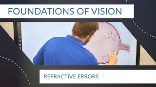 Foundations of Vision 3: Refractive Errors