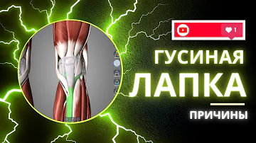#колено - Гусиная лапка - Причины и решения.
