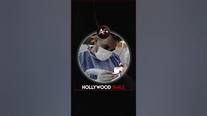 HOLLYWOOD SMİLE  |AESTHEAL CLINIC #dentist #cosmeticdentistry #smilemakeover