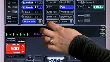 5A - Advanced Pacing - Multi-Channel Pacing