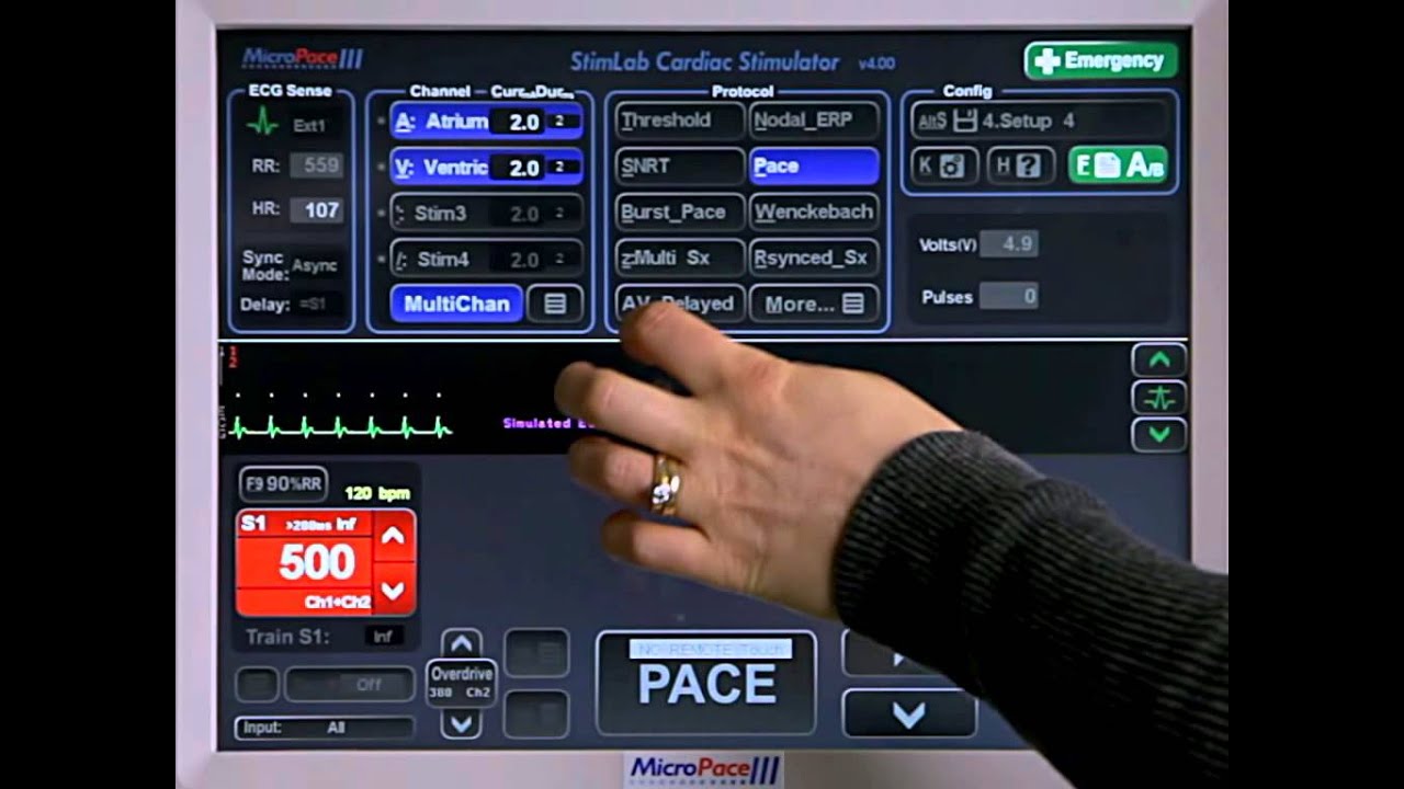 5A Advanced Pacing MultiChannel Pacing YouTube