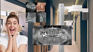 J. Morita X800 R100: The Ultimate Setup Guide for Perfect CBCT Scans