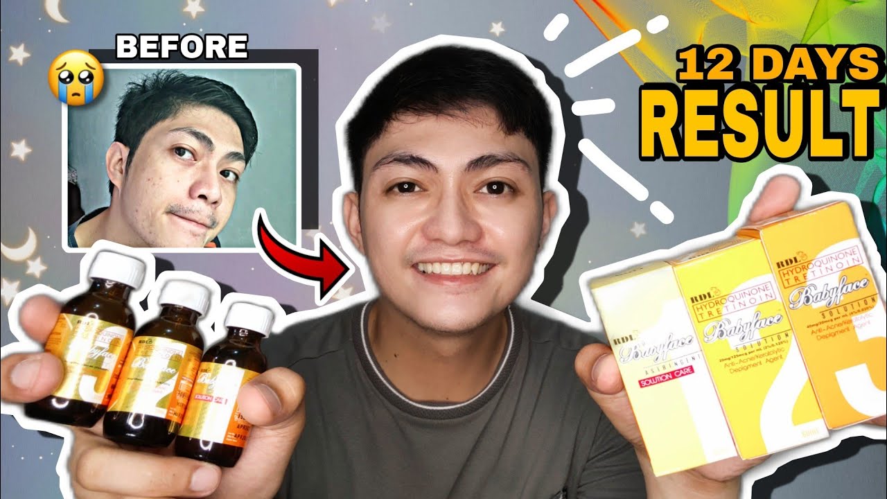 Using RDL BABYFACE SOLUTION No. 3 2 1 ngayong 2021-2022! 2weeks compilation + RESULT🤙