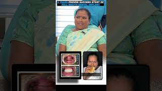 Full Mouth Dental Implants | 4-Year Life-Changing Success Story - Dr Mayur Khairnar