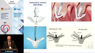 K. Spargias | Mitraclip vs. PASCAL. Similarities and differences