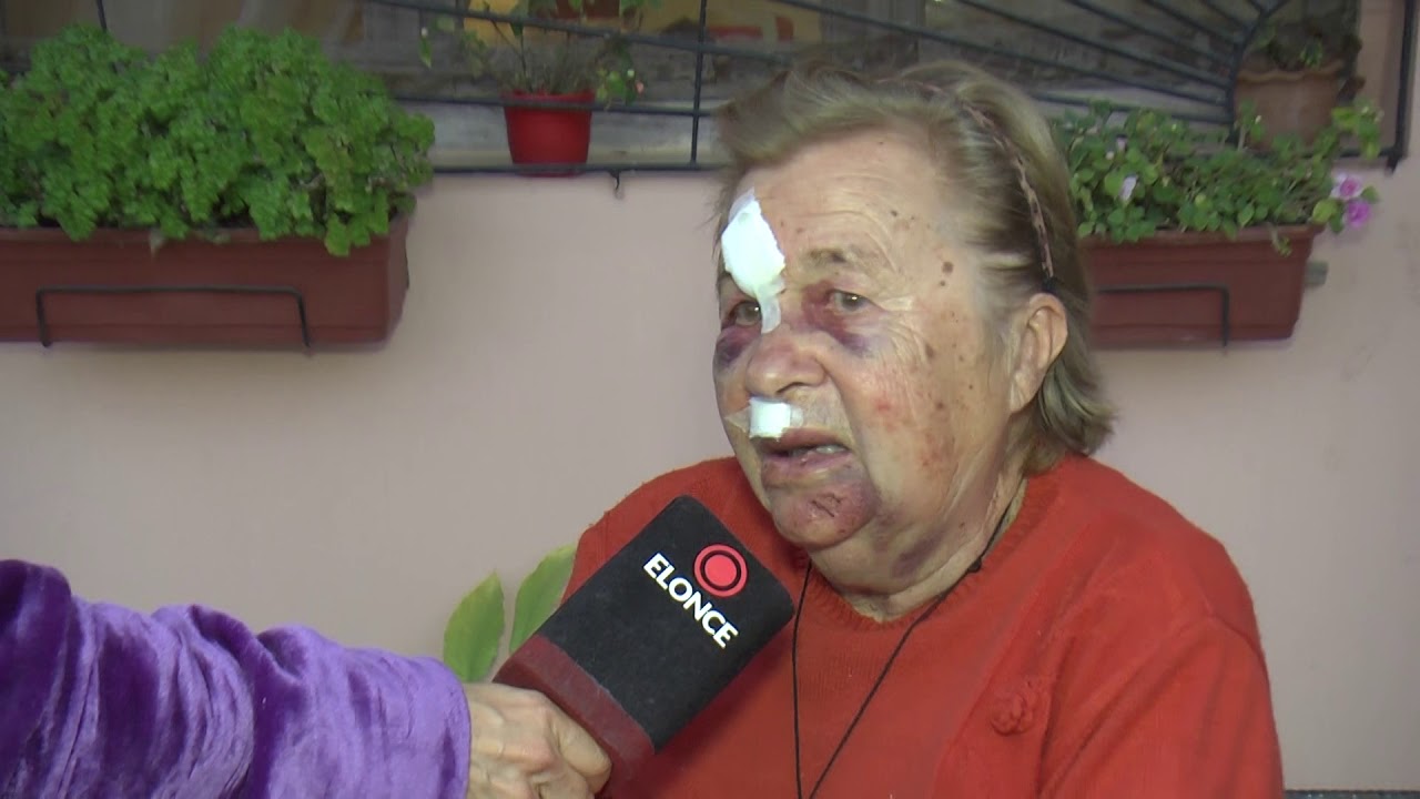 Brutal golpiza y robo a una mujer de 79 años: "Es vergonzoso lo que le hicieron"