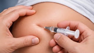 Ocksocks Injection A Step-By-Step Guide