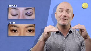 #ChasingGoals Asian Eyelid Surgery Experience with Dr. Lay - Episode 3