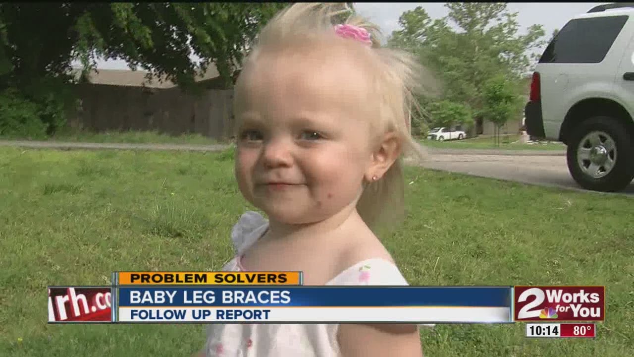 Baby Leg Braces Follow Up Report YouTube
