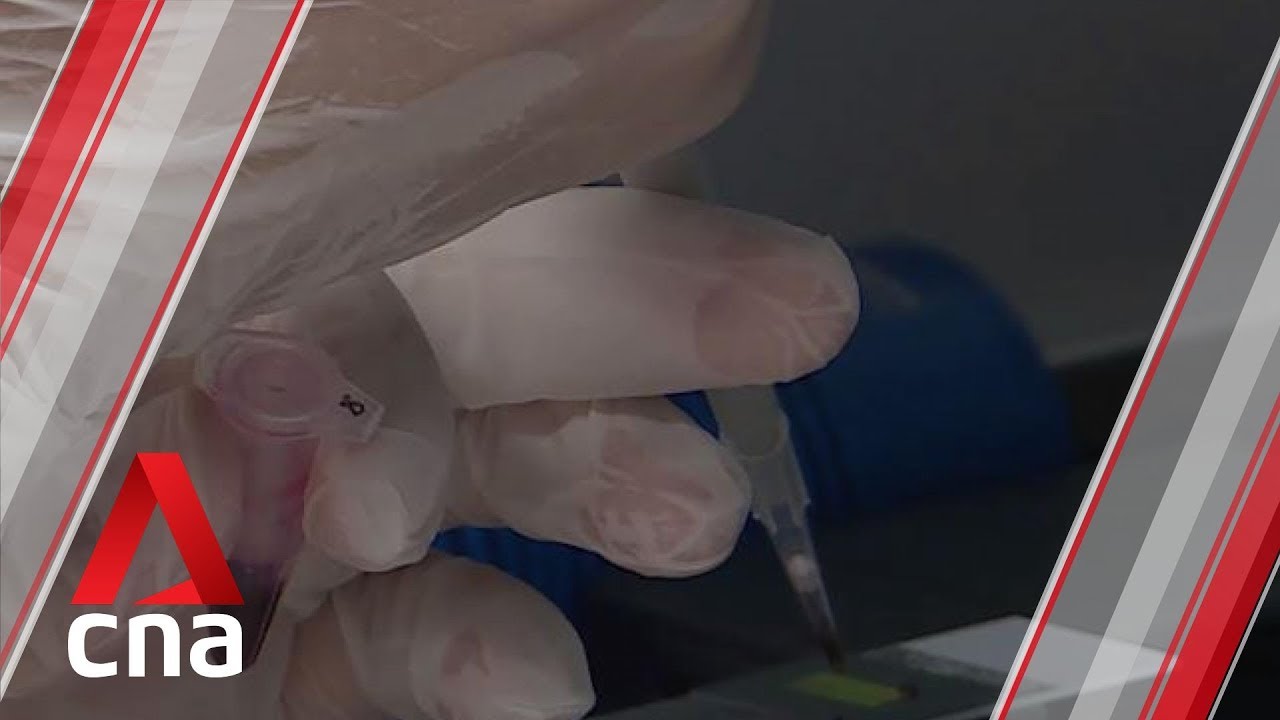 NUS researchers develop cheaper, faster, more accurate test to detect Alzheimer's