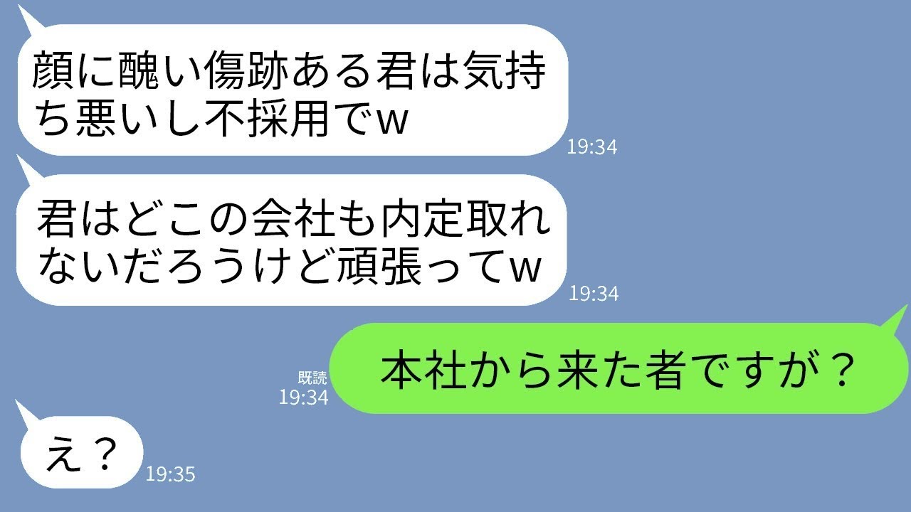 内部調査のため、身元を隠して子会社の面接を受けた俺。面接官が「その顔の傷は何だw 化け物はうちにはいらないよw」と言ってきた。→面接後、俺の正体をその厄介な面接官に伝えた結果www