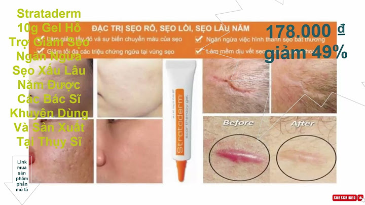 Gel strataderm trị sẹo rỗ giá bao nhiêu năm 2024