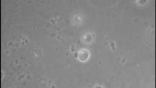 Cilium Retraction In Chytriomyces Hyalinus