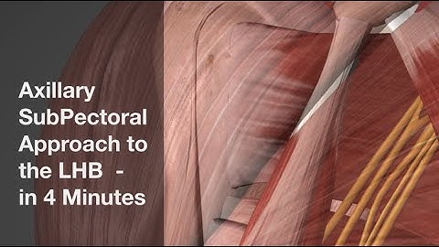 Axillary SubPectoral Approach to the LHB - in 4 Minutes