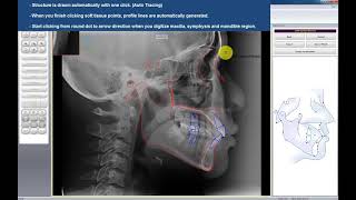 V-Ceph Training Video screenshot 5