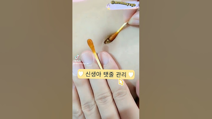 신생아 배꼽 관리는 매우 중요합니다.  이 요오도퍼 면봉.  깨끗하고 위생적#heymama #mommyego #육아소통 #추천 #유아용품