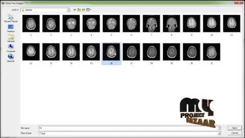 Final Year Projects | Computer aided detection of ischemic stroke using segment