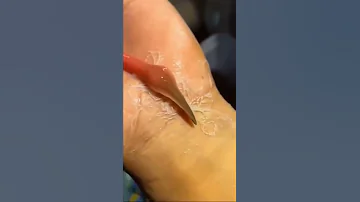 هكذا كيف تصطاد الدودة الشريطية فريستها 