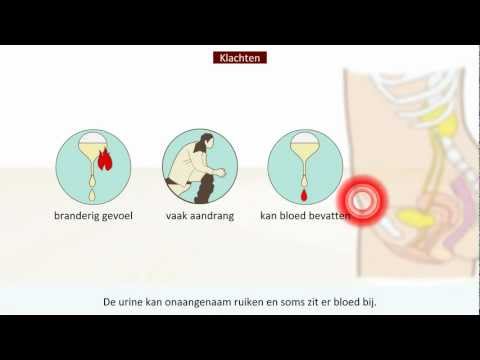 Video: Acute Cystitis - Symptomen, Behandeling Bij Vrouwen En Mannen