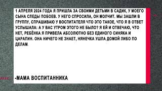 Жительница Копейска подозревает няню в детском саду в избиении ребенка