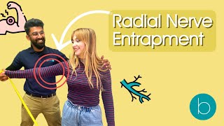 The Ultimate Guide to Radial Nerve Entrapment