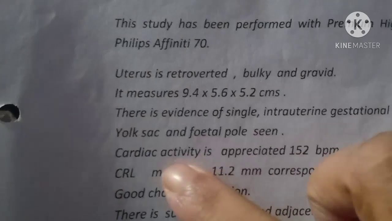 baby Boy ki ultrasound report dekhiyebabyboyultrasoundreport