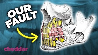 The Surprising Reason Why Human Teeth Are A Design Disaster - Cheddar Explains