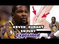 Kevin Durant INJURY Explained | Torn Achilles | Mga NBA Players na dumanas din nito