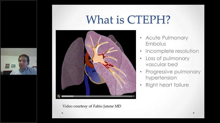 Drs. William Auger and James Welker  CTEPH Support...
