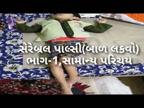 સેરેબ્રલ પાલ્સી(Cerebral Palsy,CP) સામાન્ય પરિચય ભાગ 1