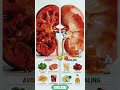 FOODS FOR AVOID AND HEALING KIDNEY🫁#ytshorts#shortsfeed#viral#healthyfood#trending#shortvideo#kidney