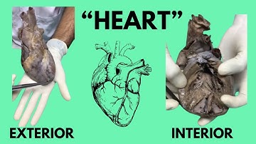 External & Internal features of All 4 Chambers of the Heart | Cadaveric Anatomy