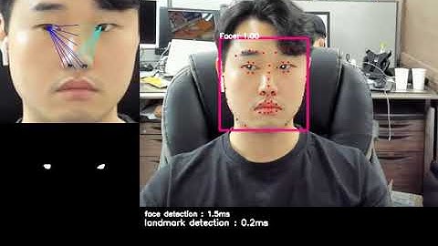Real time eyeball detection using RGB camera