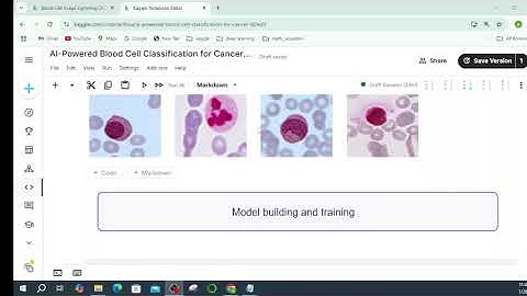 Blood Cell Image Classification for Cancer Detection: Deep Learning Approach