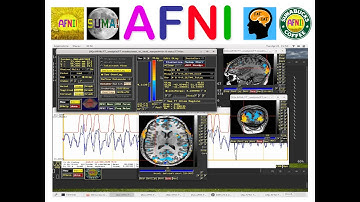 [AFNI Academy] Start to Finish Hands-On (4/17): peruse inputs