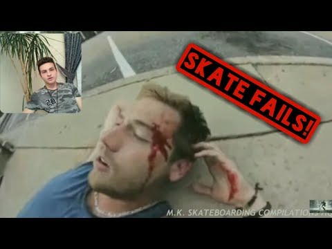 Kaykay Kazaları Tehlikeli kazalar ( Skate Fail )