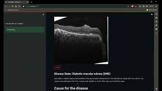 Retinal Eye Disease Detector With Chat Bot Mini Project #deeplearning #imageprocessing screenshot 4