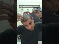 Day 29 Hair Regrowth Challenge | #hairgrowthtreatment #haircare #shortsfeed