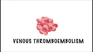 VTE Awareness and Prevention Thrombosis Canada