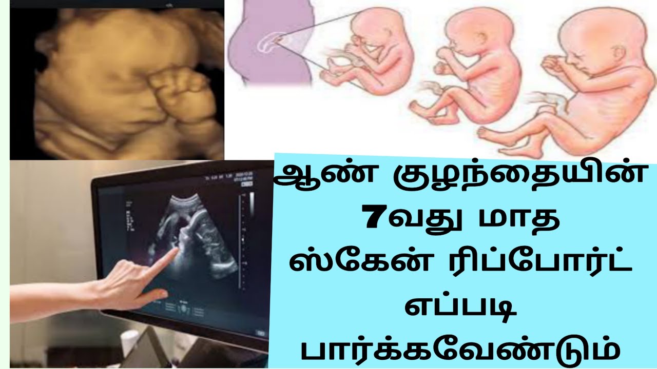 Boy Baby 7th Month Scan Report boybaby Growth Scan Report In Tamil boy-baby-7th-month-scan-report-boybaby-growth-scan-report-in-tamil