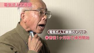 喉頭全摘出後の代用発声