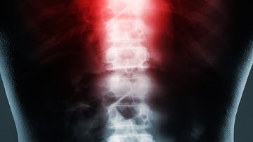 Innovations in Spinal Treatment using Electrophoretic Tissue Clearing