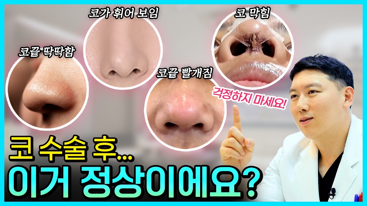 #코수술 #코성형 #코수술증상 #코수술후기 #코수술회복 #코성형부기 #박기수 #제이준성형외과피부과